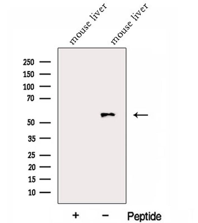 FUCA1 Antibody in Western Blot (WB)