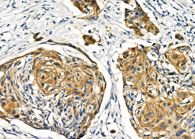 GCKR Antibody in Immunohistochemistry (Paraffin) (IHC (P))