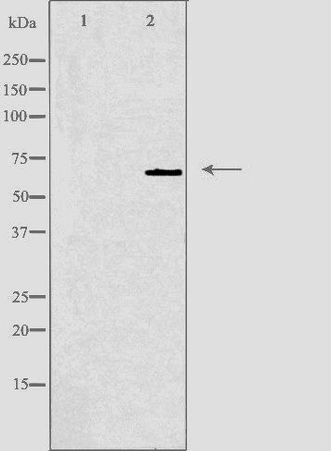 GCKR Antibody in Western Blot (WB)