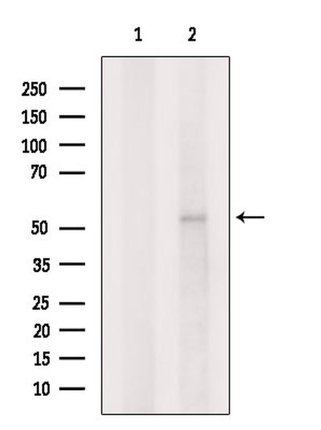 GLRA2 Antibody in Western Blot (WB)