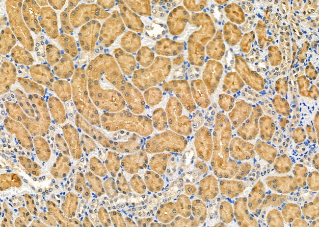 GSR Antibody in Immunohistochemistry (Paraffin) (IHC (P))