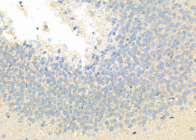 HECW1 Antibody in Immunohistochemistry (Paraffin) (IHC (P))