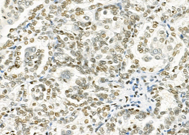 HKR1 Antibody in Immunohistochemistry (Paraffin) (IHC (P))