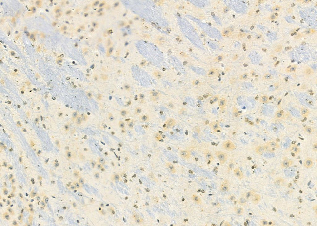 HKR1 Antibody in Immunohistochemistry (Paraffin) (IHC (P))