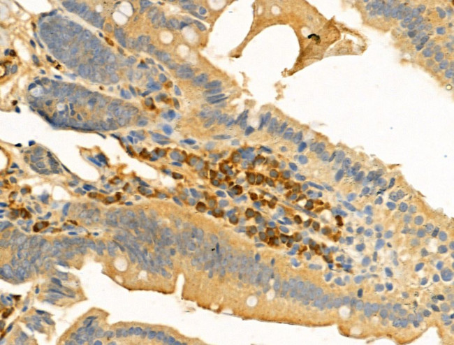 HYAL2 Antibody in Immunohistochemistry (Paraffin) (IHC (P))