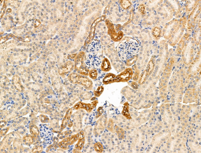 Kappa Light Chain Antibody in Immunohistochemistry (Paraffin) (IHC (P))