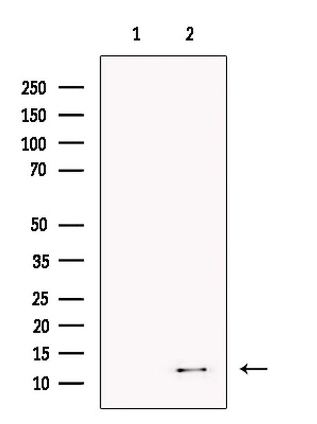 Kappa Light Chain Antibody in Western Blot (WB)