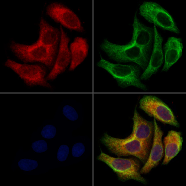 KCNN2 Antibody in Immunocytochemistry (ICC/IF)