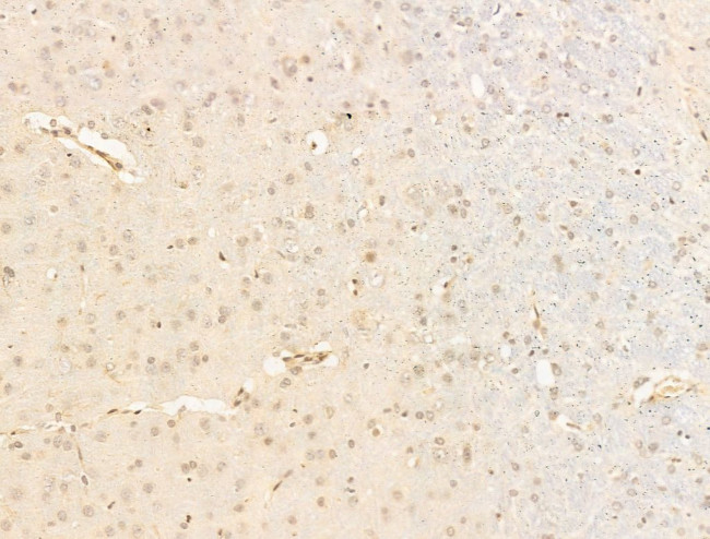 JARID1C Antibody in Immunohistochemistry (Paraffin) (IHC (P))