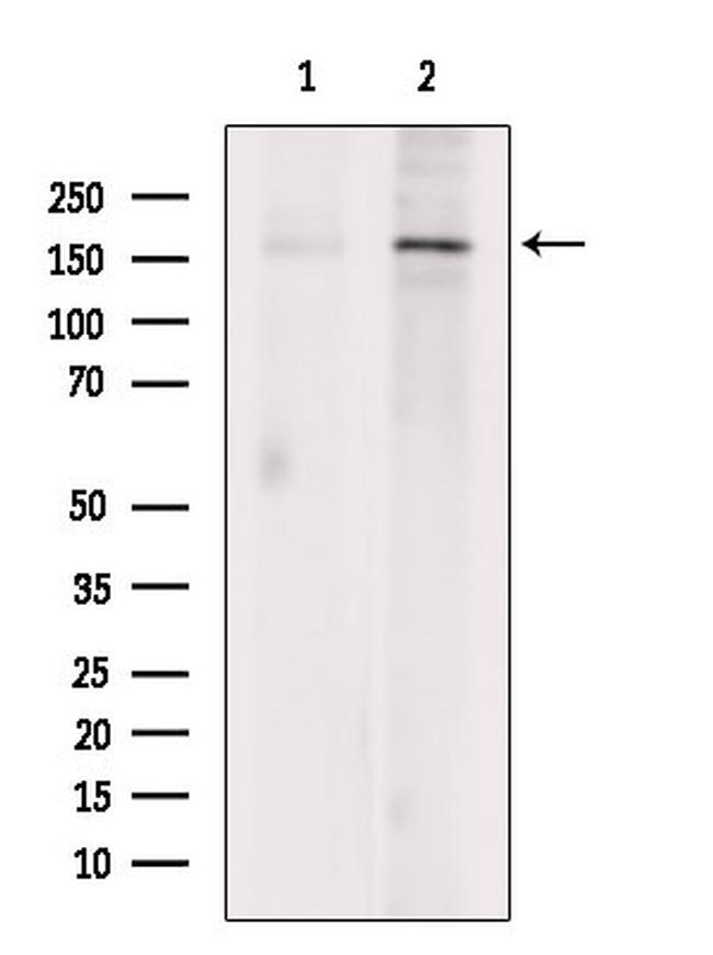 JARID1C Antibody in Western Blot (WB)