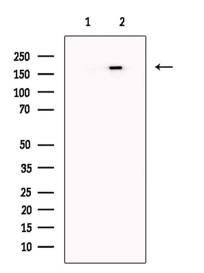 JARID1C Antibody in Western Blot (WB)