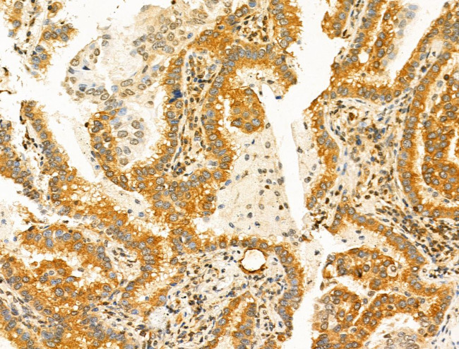 KV1.3 (KCNA3) Antibody in Immunohistochemistry (Paraffin) (IHC (P))