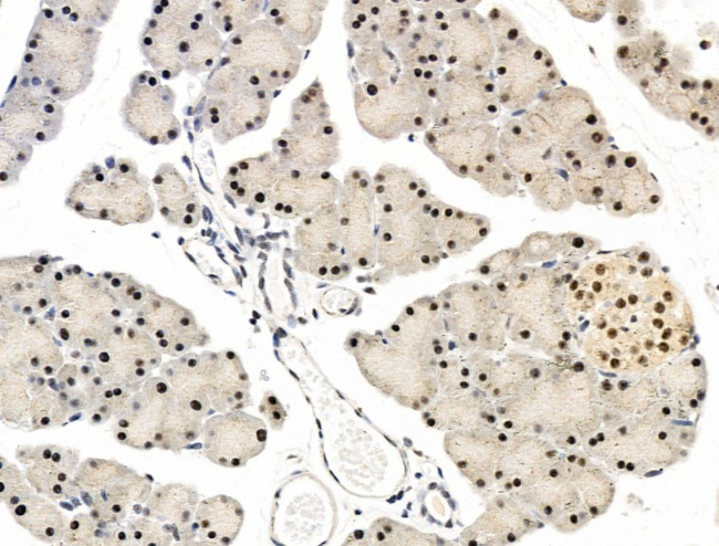 L3MBTL1 Antibody in Immunohistochemistry (Paraffin) (IHC (P))