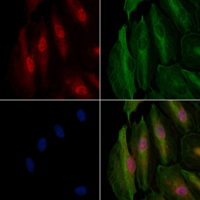 LIS1 Antibody in Immunocytochemistry (ICC/IF)