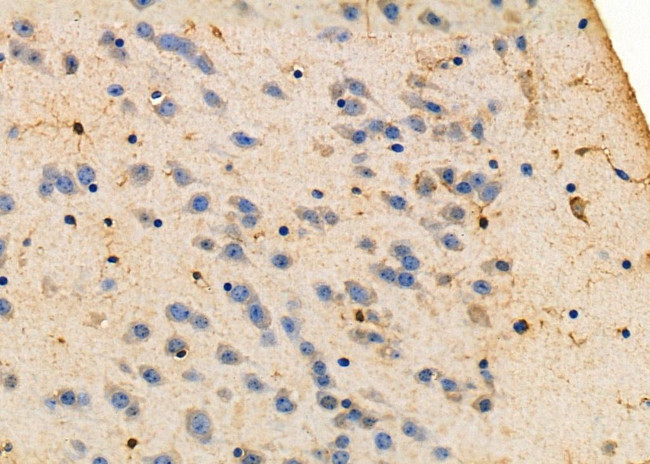 LIS1 Antibody in Immunohistochemistry (Paraffin) (IHC (P))