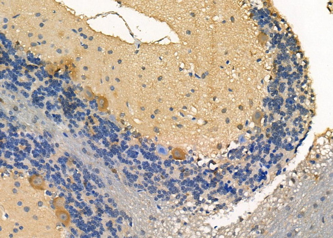 LIS1 Antibody in Immunohistochemistry (Paraffin) (IHC (P))