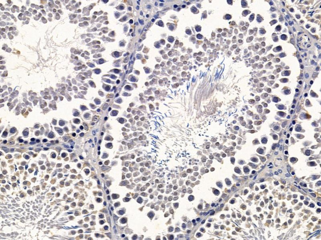 KARS Antibody in Immunohistochemistry (Paraffin) (IHC (P))