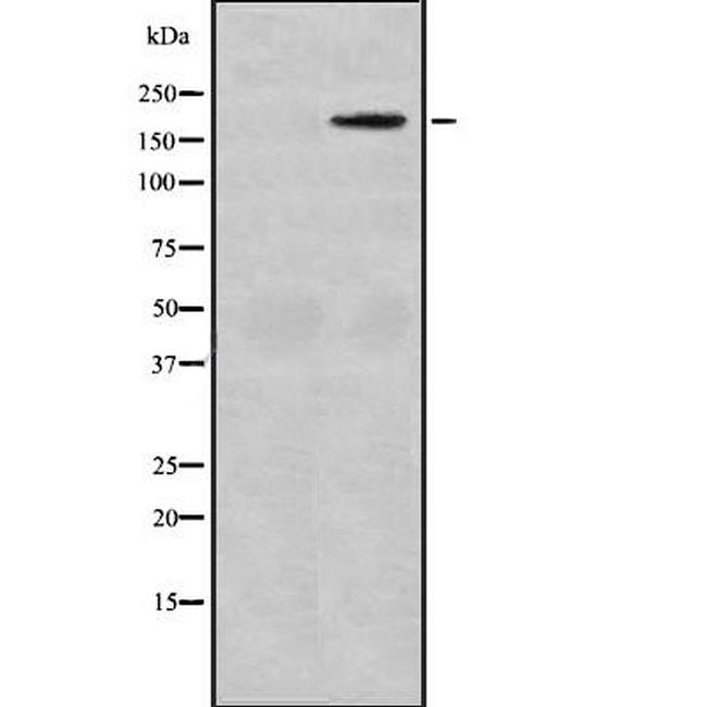 MAST1 Antibody in Western Blot (WB)