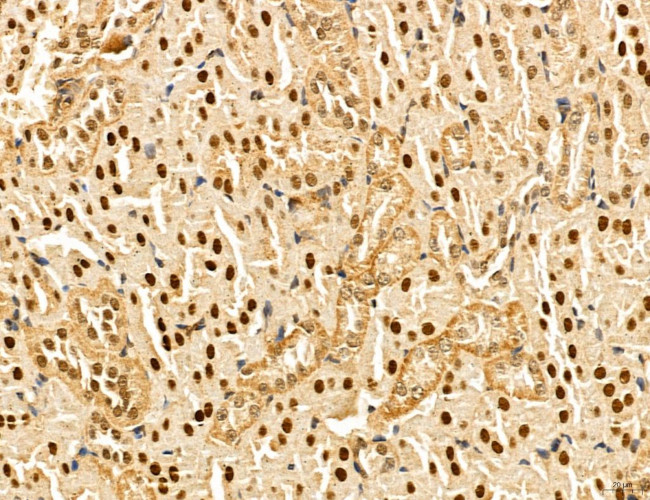 MAT2A Antibody in Immunohistochemistry (Paraffin) (IHC (P))