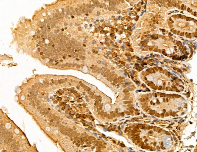 MAT2A Antibody in Immunohistochemistry (Paraffin) (IHC (P))