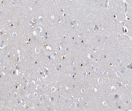 MEF2C Antibody in Immunohistochemistry (Paraffin) (IHC (P))