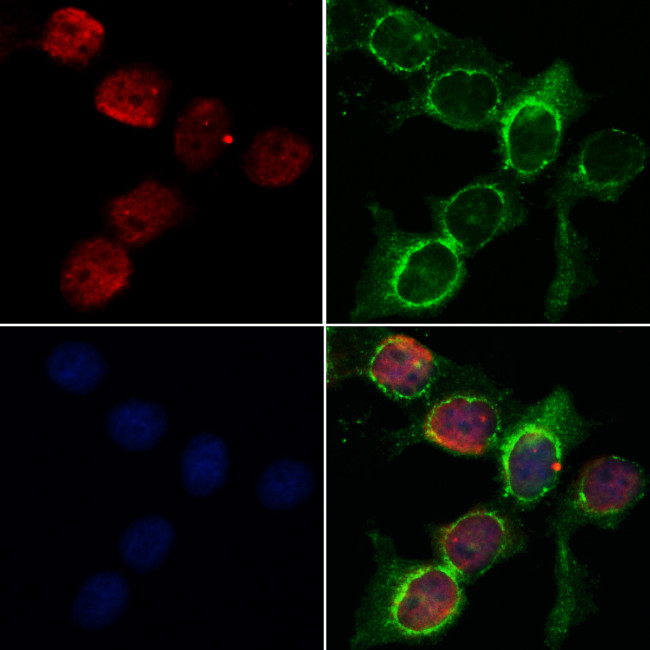 MEF2C Antibody in Immunocytochemistry (ICC/IF)