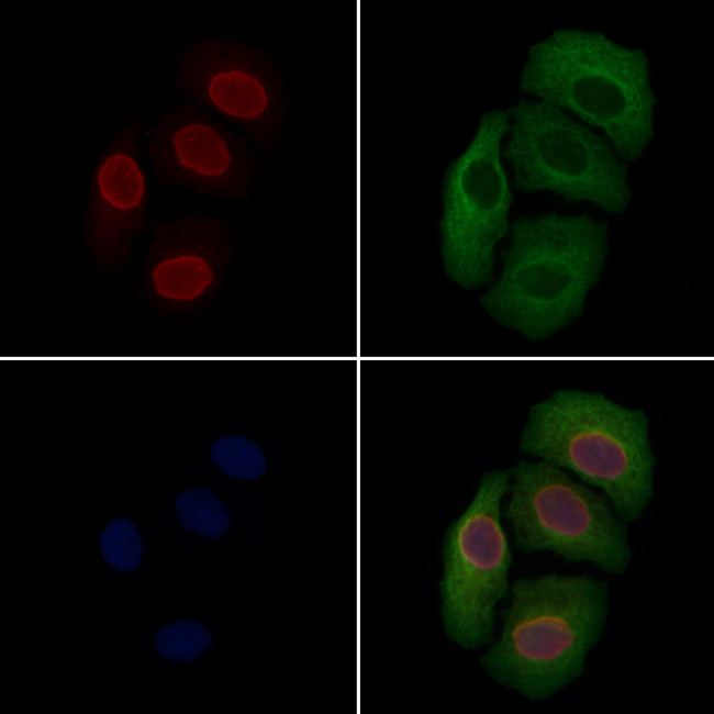 MUM1 Antibody in Immunocytochemistry (ICC/IF)