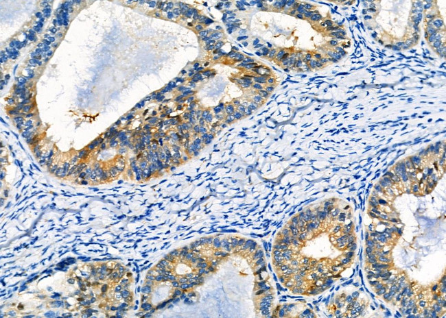 CD56 Antibody in Immunohistochemistry (Paraffin) (IHC (P))