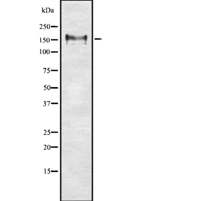 CD56 Antibody in Western Blot (WB)