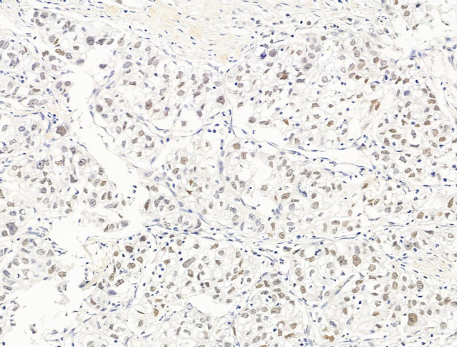 Nesprin 1 Antibody in Immunohistochemistry (Paraffin) (IHC (P))