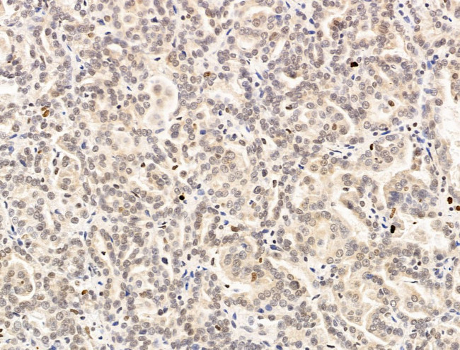 Nesprin 1 Antibody in Immunohistochemistry (Paraffin) (IHC (P))