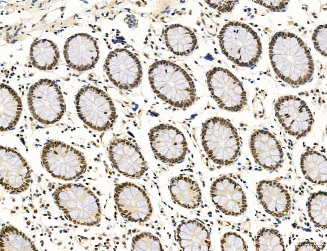 SP7 Antibody in Immunohistochemistry (Paraffin) (IHC (P))