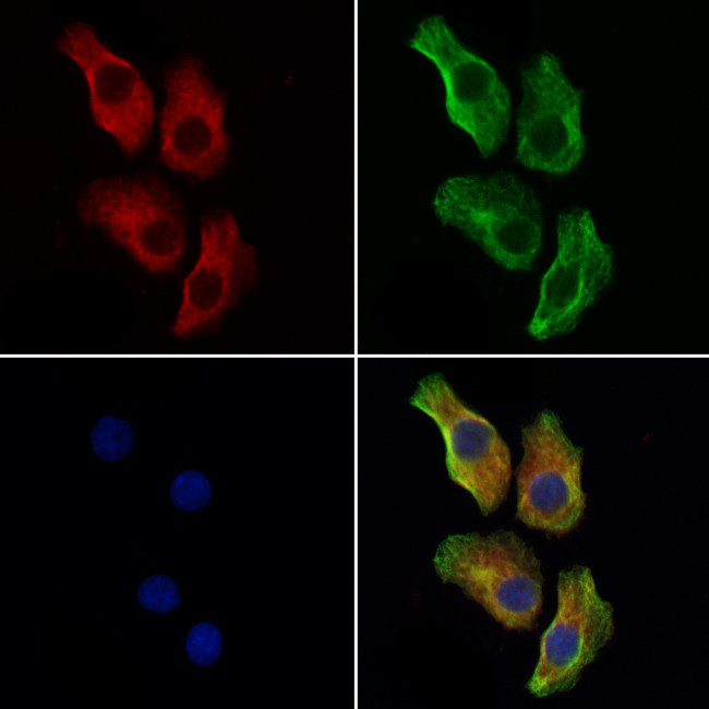 P2X2 Antibody in Immunocytochemistry (ICC/IF)