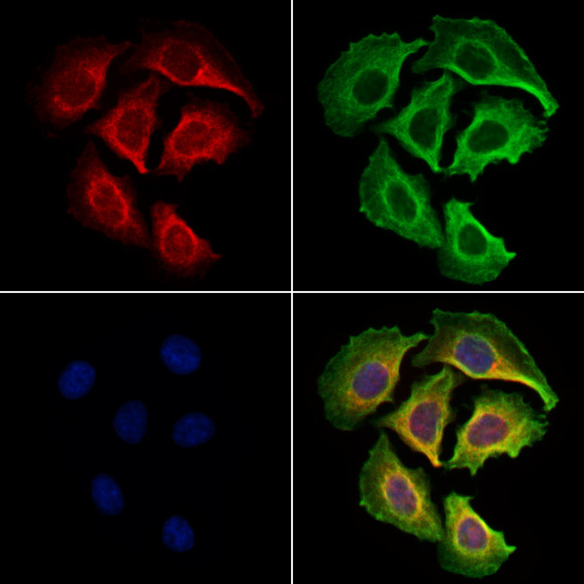 PDE1C Antibody in Immunocytochemistry (ICC/IF)