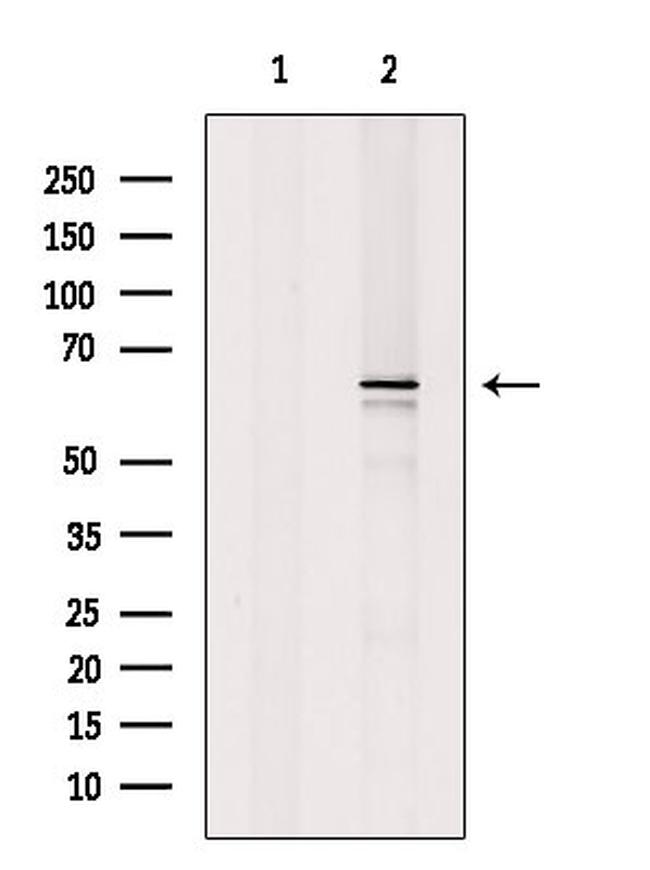 PDPK1 Antibody in Western Blot (WB)