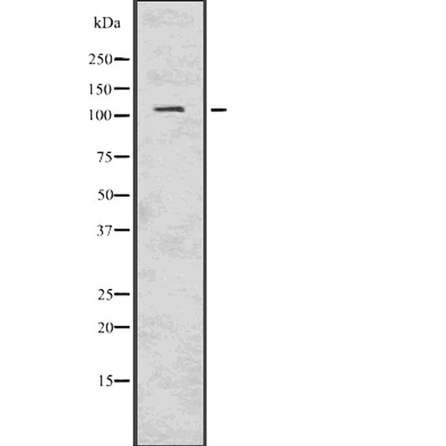PIK3CD Antibody in Western Blot (WB)