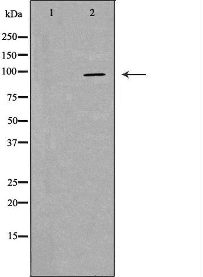 PIWIL4 Antibody in Western Blot (WB)