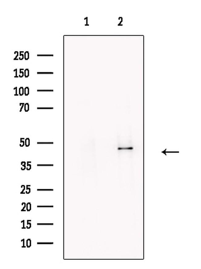 RAPSN Antibody in Western Blot (WB)