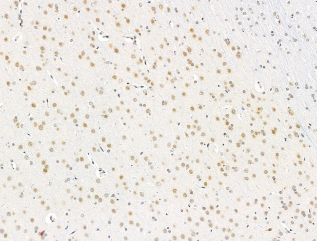 RECQL5 Antibody in Immunohistochemistry (Paraffin) (IHC (P))