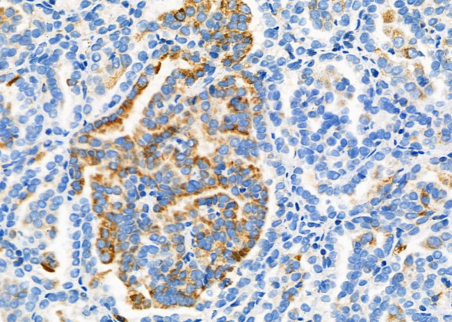 ROBO1 Antibody in Immunohistochemistry (Paraffin) (IHC (P))