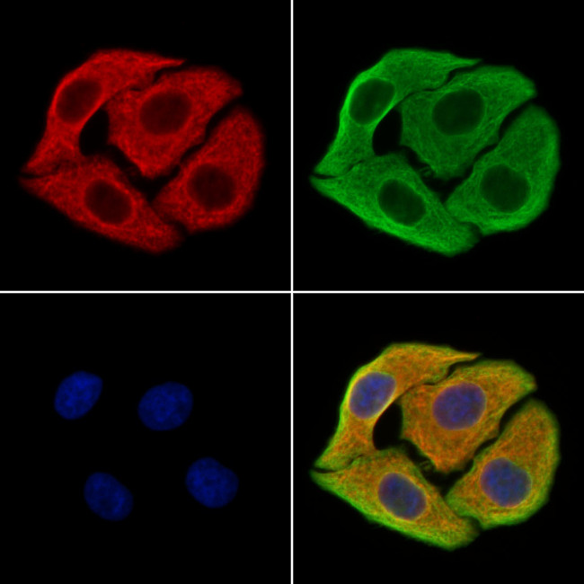 SAA2 Antibody in Immunocytochemistry (ICC/IF)