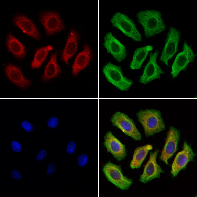 SEC61A1 Antibody in Immunocytochemistry (ICC/IF)