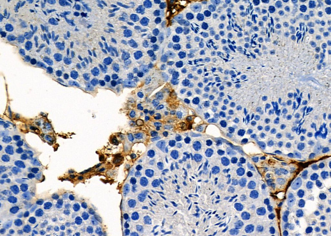 SRD5A2 Antibody in Immunohistochemistry (Paraffin) (IHC (P))