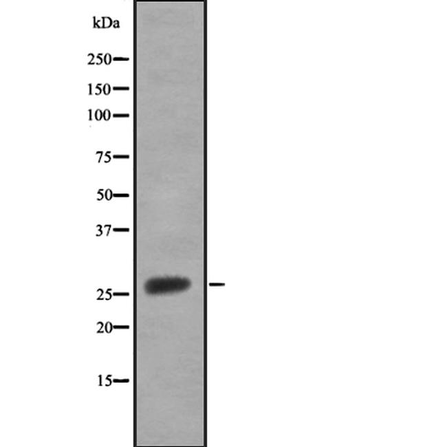 SRD5A2 Antibody in Western Blot (WB)