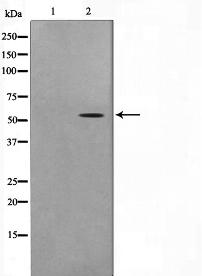 STEAP3 Antibody in Western Blot (WB)