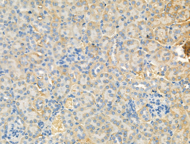 Syntrophin alpha-1 Antibody in Immunohistochemistry (Paraffin) (IHC (P))