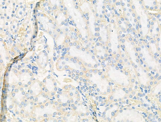 Syntrophin alpha-1 Antibody in Immunohistochemistry (Paraffin) (IHC (P))