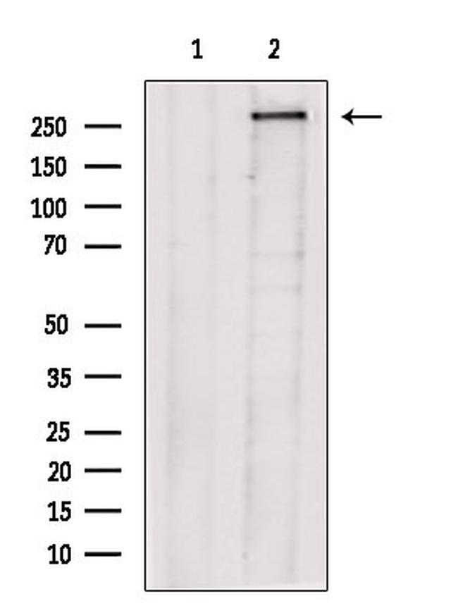 TACC2 Antibody in Western Blot (WB)