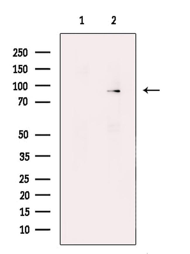 TAP1 Antibody in Western Blot (WB)