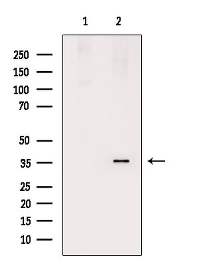 TIRAP Antibody in Western Blot (WB)